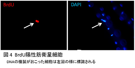 図4　BrdU陽性筋衛星細胞