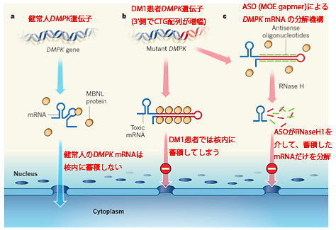 図4　ASOによるDM1治療のメカニズム